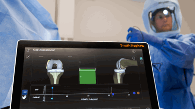 Surgery Monitor Photo